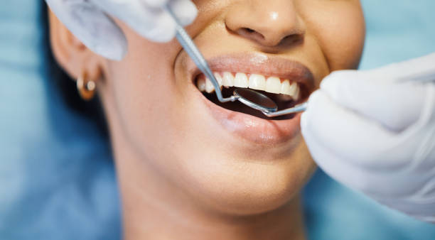 Best Emergency Gum Treatment in Greenville, AL